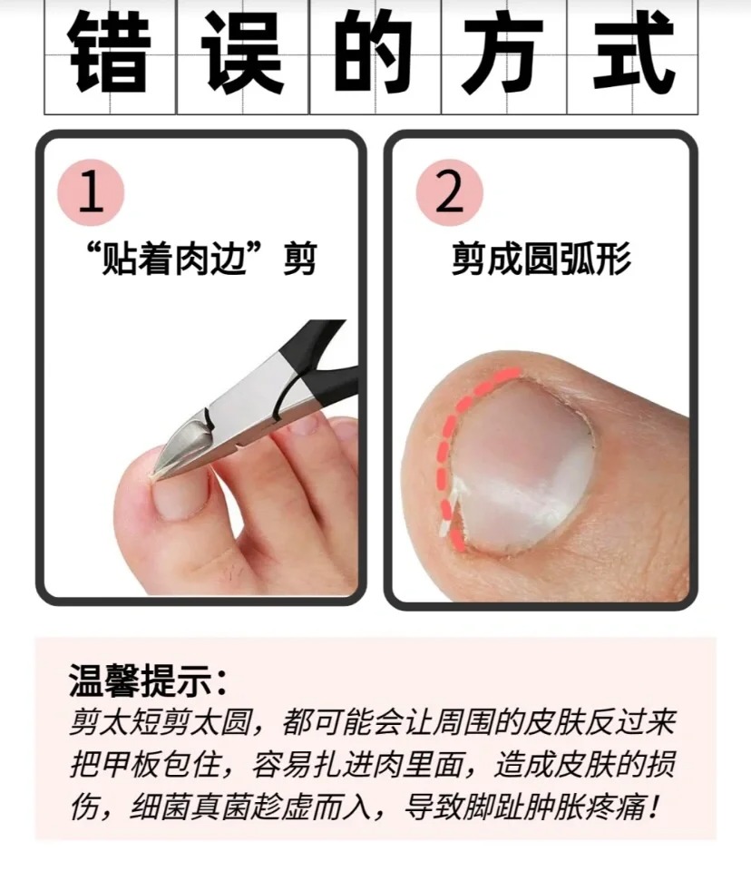 剪指甲的学问_3_七素家_来自小红书网页版
