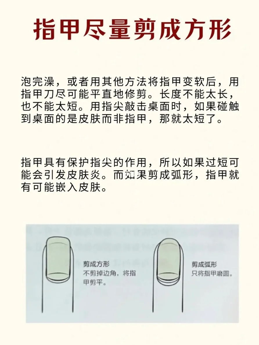 学习正确剪甲_2_枣点睡觉_来自小红书网页版